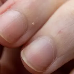 Zbliżenie na paznokcie, ukazujące ich naturalny wygląd i teksturę. Zastanawiasz się, jak szybko rosną paznokcie? Ten obrazek pokazuje ich aktualny stan.
