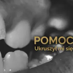 Zbliżenie na ukruszony ząb, z napisem "POMOCY! Ukruszył mi się ząb".