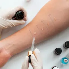 Alergia to choroba przewlekła? Sprawdź, co to oznacza dla Ciebie