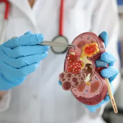 Urolog: Kto to, co leczy i kiedy wizyta ratuje zdrowie?