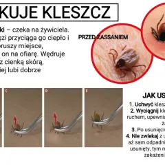 Zdjęcie przedstawia kleszcza **ixodes ricinus** przed, w trakcie i po zassaniu, a także instrukcję usuwania go.