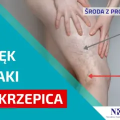 Jak zapobiec zakrzepicy? Skuteczny poradnik dla zdrowych żył
