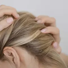 Mani che si grattano il cuoio capelluto biondo con forfora. Il tea tree a cosa serve? Aiuta a combattere la forfora e a purificare.
