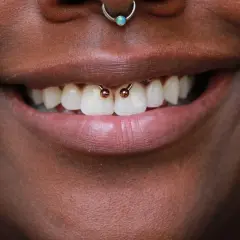 Uśmiechnięte usta z widocznym smiley piercingiem między zębami.