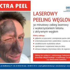 Mężczyzna z połową twarzy pokrytą czarną maską węglową po zabiegu Spectra Peel. Laserowy peeling węglowy nie powoduje skutków ubocznych jak zaczerwienienie czy złuszczanie.
