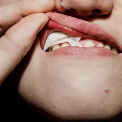 En person tar bort en snusprilla från munnen. Kanske är personen allergisk mot snus och upplever irritation.