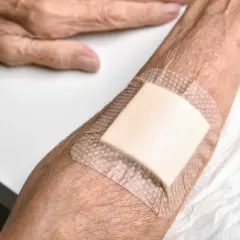 Opatrunki ze srebrem na trudno gojące się rany na skórze starszej osoby.
