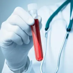 Ręka w białej rękawiczce trzyma probówkę z czerwoną cieczą, prawdopodobnie badanie na obecność fibrynogenu. Stetoskop na szyi lekarza.