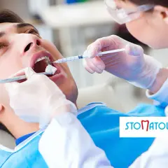 Znieczulenie u dentysty: bez bólu i strachu? Przewodnik eksperta