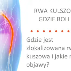Rwa kulszowa objawy gdzie boli? Ilustracja pokazuje przebieg nerwu kulszowego, który może być przyczyną bólu.
