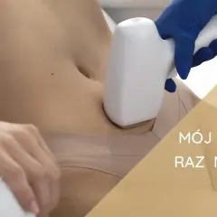 Epilacja laserowa: Co to jest i czy to rozwiązanie dla Ciebie?