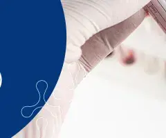 Kiedy badać FSH? Kluczowe informacje dla zdrowia hormonalnego