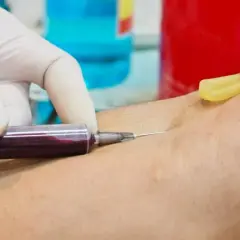 Jak przygotować się do badania cholesterolu, aby uniknąć błędów
