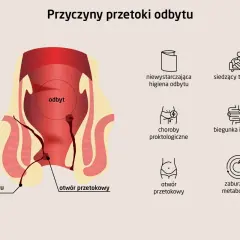 Schemat anatomiczny przedstawiający przetokę odbytu i jej potencjalne przyczyny, takie jak choroby proktologiczne czy zaburzenia metabolizmu.