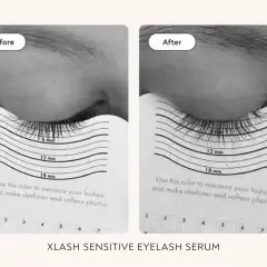 Före- och efterbilder som visar hur fransarna växer med Xlash prostaglandin. Mätning visar tydlig längdökning.