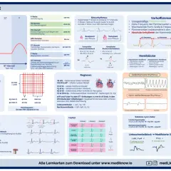 EKG-Schema erklärt Herzinfarkt-Anzeichen: ST-Strecken-Veränderungen wie bei STEMI, Perikarditis oder Tachykardien.