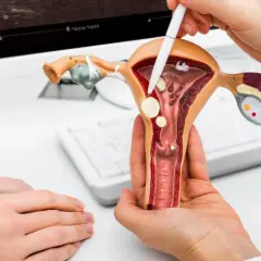 Model narządu rodnego kobiety z zaznaczonymi zmianami, które mogą wskazywać na raka endometrium. Lekarz wyjaśnia pacjentce.