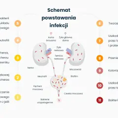 Schemat powstawania infekcji dróg moczowych, od zanieczyszczenia do bakteriemii. Czy zapalenie pęcherza jest zaraźliwe? Schemat pokazuje drogę infekcji.