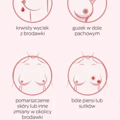 Ilustracja pokazuje objawy, które mogą wskazywać na nowotwór złośliwy sutka: zmiany brodawki, guzek, obrzęk, zaczerwienienie, ból.
