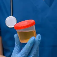 Medyk w niebieskim fartuchu trzyma pojemnik z próbką moczu. Analiza białka w moczu pomoże określić normy.
