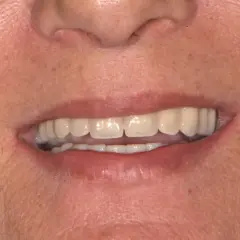 Un sorriso smagliante, ma attenzione: il tè macchia i denti.