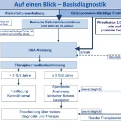 Die entscheidenden Schritte zur Osteoporose Diagnostik verstehen