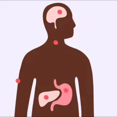 Illustration av en mänsklig silhuett med markerade organ som hjärna, hals, mage och lever. Röda prickar indikerar potentiella problemområden, vilket väcker frågan: kan man få feber av stress?