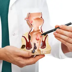 Lekarz od odbytu pokazuje na modelu anatomicznym zmiany chorobowe.