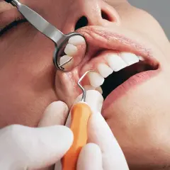Dettaglio di un intervento di curettage gengivale, con strumento dentale che pulisce la zona tra dente e gengiva.