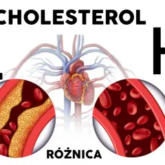 Dobry czy zły cholesterol? Rozróżnij HDL i LDL i zadbaj o serce!