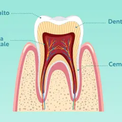 Sezione di un dente che mostra la struttura: smalto, dentina, polpa dentale e cemento.