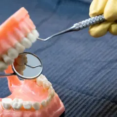 Model szczęki z widoczną próchnicą z boku zęba, badany lusterkiem dentystycznym.
