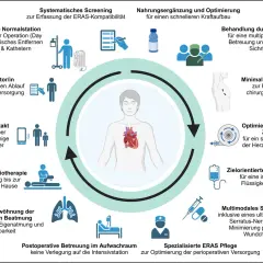 Das ERAS Konzept zeigt den Kreislauf der perioperativen Versorgung mit Fokus auf Patientenzentrierung und schnelle Genesung.