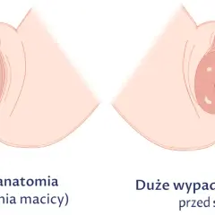 Obniżona macica po porodzie: 7 objawów, które musisz znać