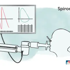 Spirometrie-Diagramm zeigt Lungenfunktion. Bei COPD Gold 3 ist der GdB oft hoch.
