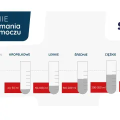 Grafika przedstawia stopnie nietrzymania moczu: kropelkowe, lekkie, średnie, ciężkie i bardzo ciężkie, z podziałem na ilości wydalanego moczu. Pomaga dobrać odpowiedni zabieg.