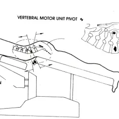 Ilustracja pokazuje technikę terapii manualnej kręgosłupa, która może pomóc w odpowiedzi na pytanie: czy wypuklina może się cofnąć.
