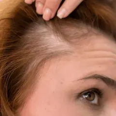 Primer plano de una mujer revisando su cuero cabelludo, preocupada por evitar la caída del cabello.