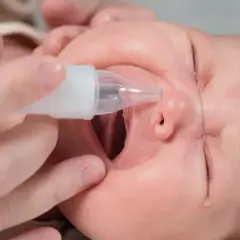 Un bebé recibe un lavado nasal con un aspirador.