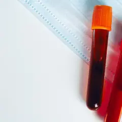 Dwie probówki z krwią, jedna z pomarańczową, druga z czerwoną zakrętką, leżą na masce ochronnej. Wyniki badania kreatyniny wkrótce będą gotowe.