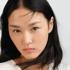 Jeune femme au visage marqué par des imperfections. Elle cherche des solutions sur que faire contre la peau grasse.