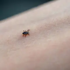 Do jakiego lekarza z kleszczem? Sprawdź, gdzie szukać pomocy!