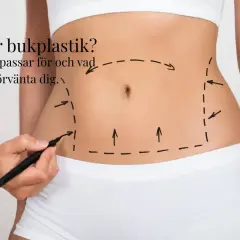 En hand markerar med penna en linje runt en mage, som visar området för en bukplastik. Texten frågar "Vad är bukplastik?".