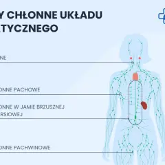 Schemat układu limfatycznego z zaznaczonymi węzłami chłonnymi: szyjnymi, pachowymi, w jamie brzusznej i klatce piersiowej, oraz pachwinowymi.