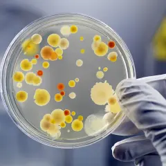 Kolonie bakterii na szalce Petriego, badane w laboratorium. To może być początek badań nad nowym probiotyk lek.
