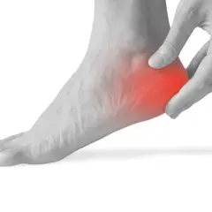 Mano che preme sul tallone sinistro, evidenziato in rosso, per indicare dolore al tallone sinistro a riposo.