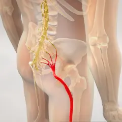 Widok anatomiczny ukazujący nerw kulszowy w czerwonym kolorze, biegnący od miednicy w dół nogi, aż do stopy.