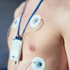 Mężczyzna z elektrodami EKG na klatce piersiowej i podłączonym urządzeniem. To badanie holterowskie, które pomaga ocenić pracę serca.