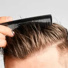 Hombre peinando su cabello, buscando recuperar pelo entradas naturalmente.