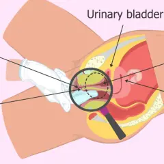 Anatomia kobieca: cewka moczowa, gruczoły Skene'a, pęcherz, macica i punkt G. Czy to squirt?